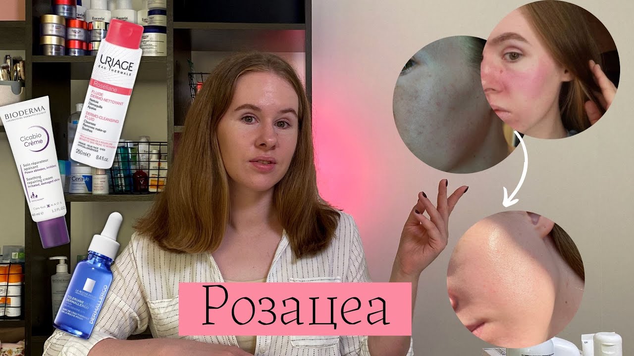 Фото 46 — Лучшие средства для ухода за кожей и волосами для роста